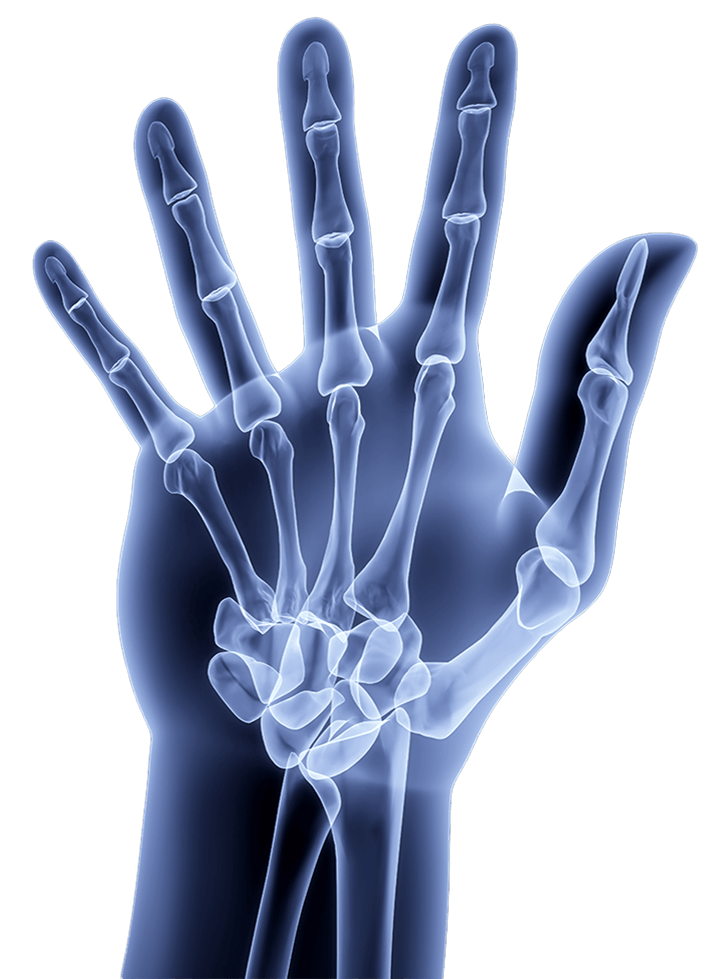Fractures de la main, poignet et doigts