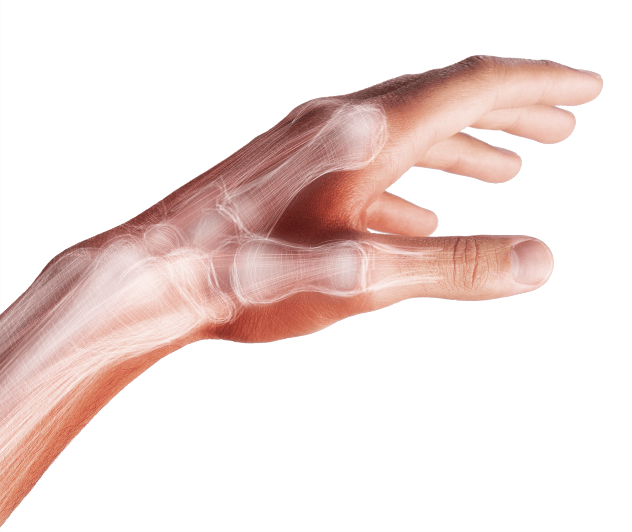 Douleur de la main et des doigts : que faire ?